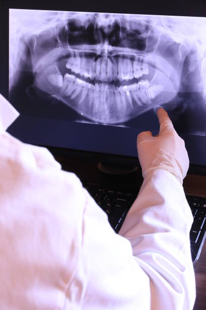 Best Dentist for Tooth Abscess  in Mountain House, CA