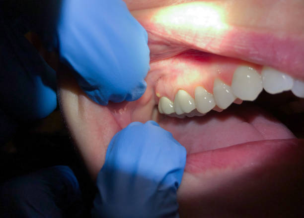 Best Teeth Whitening  in Mountain House, CA