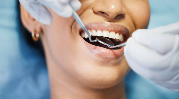 Best Emergency Dentist Near Me  in Mountain House, CA