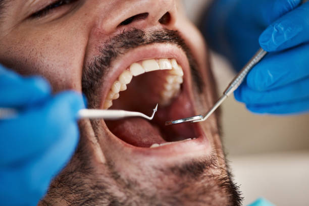 Best Walk-In Dentist Near Me  in Mountain House, CA