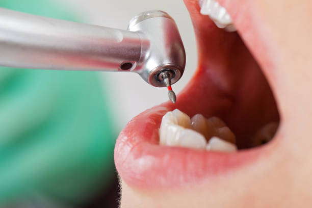 Best Emergency Dentist Open Today  in Mountain House, CA
